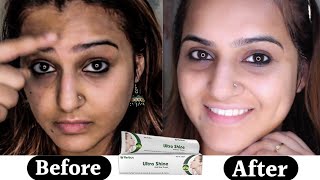तेजी से रंग गोरा करने की क्रीम | Ultra Shine Anti Scar Face Cream | Remove Pigmentation Darkspot