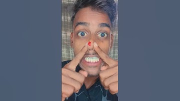 How I Cured a Bug Bite with Yogurt i ...#shorts#video#