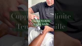 Cupping Pour Le Tendon Dachille Soulagement Et Récupération Rapide