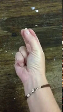 Stabilization of ulnar fingers