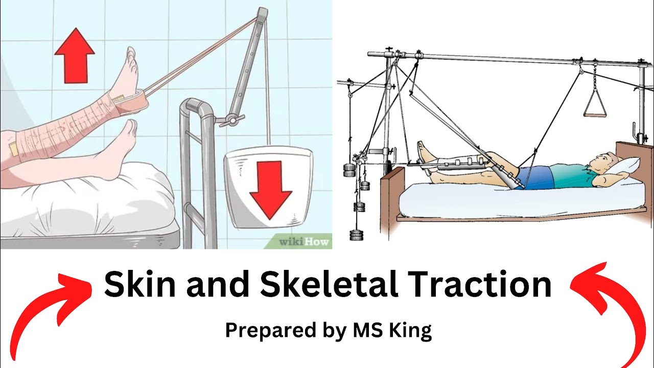 Skin and Skeletal Traction 