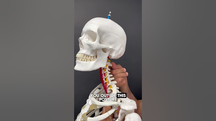 Part 1: How to STOP Jaw Clenching! #jawpaintreatment #jawpain #tmjdisorder #tmj #jawpainrelief