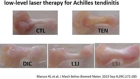 CHIROPRACTIC AND LASER THERAPY FOR NECK AND BACK P...