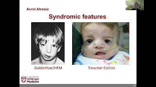 Otologic Care Of The Craniofacial Patient- 2022 Uchicago Ear And Hearing Symposium