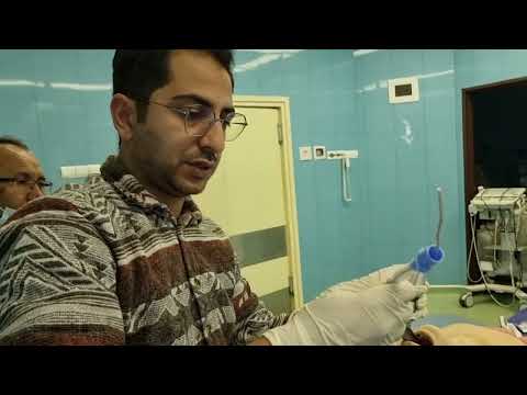 انتوباسیون بیمار بدون استفاده از ویدیو لارنگوسکوپ