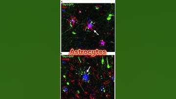 The Fascinating World of Astrocytes