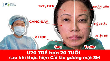 KINH NGẠC quý bà U70 TRẺ MƠN MỞN 20 TUỔI nhờ Bác sĩ Tú Dung Cải lão gương mặt 3M HỒI XUÂN
