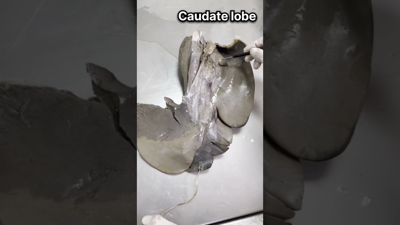 liver of horse anatomy