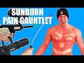 Extreme sunburn pain gauntlet peak suffering achieved  bodybuilder vs sunburn slapping experiment