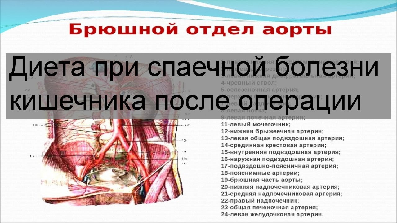 Диета при спаечной болезни кишечника после операции