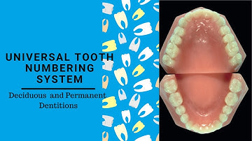 Universal tooth Notation System | Tooth Numbering System