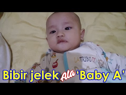  bayi  Bayi Jelek 