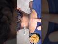 Neck Darkness Removal Tips | Remove Neck Tan Easily At Home #neckdarknessremoval #ytshorts
