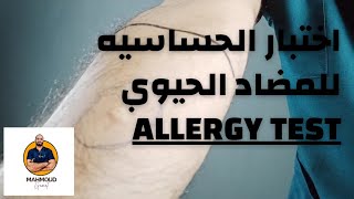 طريقه عمل اختبار الحساسيه بطريقه صحيحة Allergy test