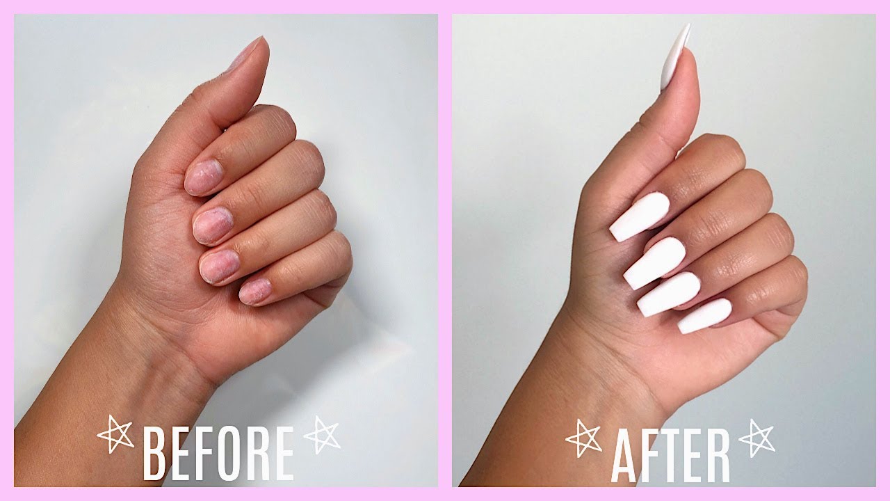 Do Acrylics Hurt / Artificial Nails Types Problems And Treatments