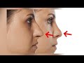 Rhinoplasty can give you smaller lips  dr gary linkov