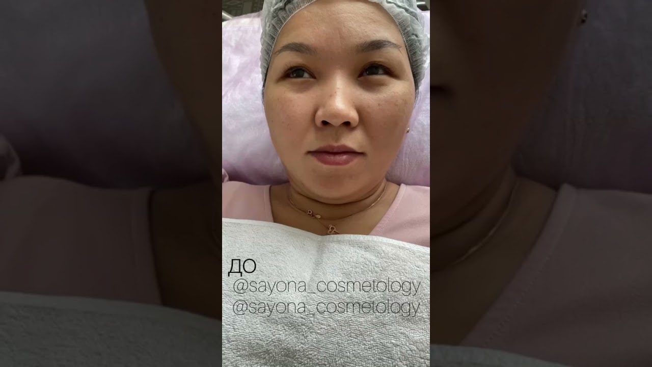 ZAN FACTOR  CRYSTAL PEEL 20% Всесезонный