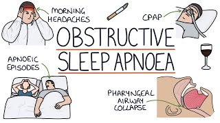 Obstructive Sleep Apnoea screenshot 4