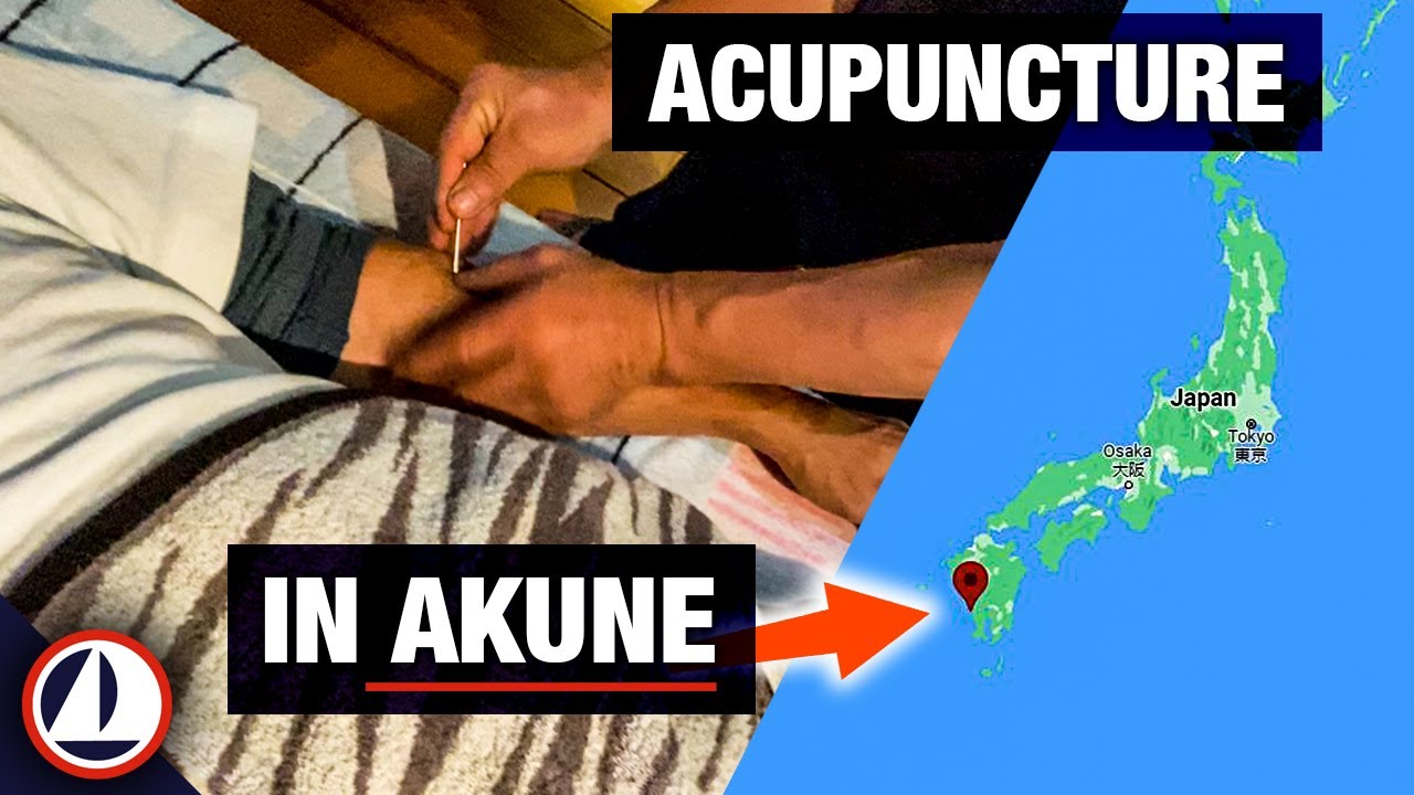 Cruising Japan #solosailor #nevertoolate acupuncture treatment