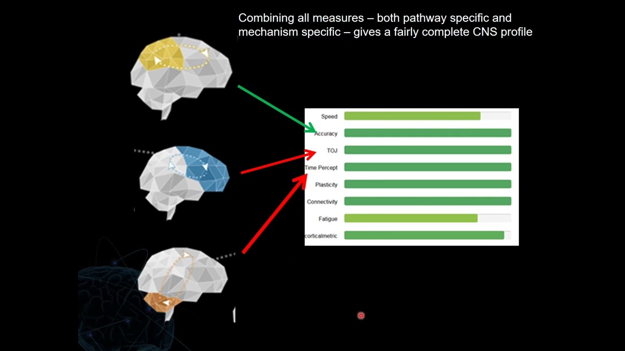 Overview of CorticalMetrics