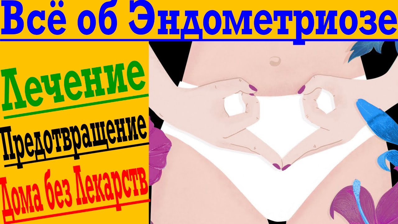 Эндометриоз – всё что нужно знать для лечения и профилактики ! Без лекарств, врачей и операций !