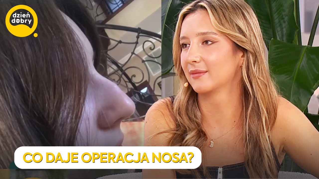 OPERACJA NOSA ZMIENIŁA JEJ ŻYCIE! | Dzień Dobry TVN