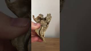 Petrous Portion of Temporal Bone