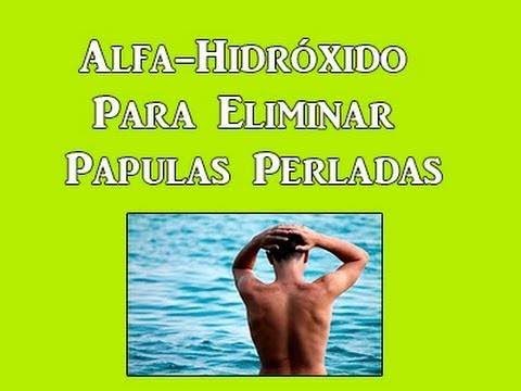 Alcohol yodado para adelgazar