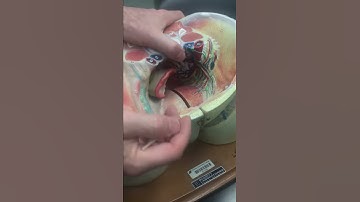 Lymph Nodes of the Pelvic Area with Dr. Masi