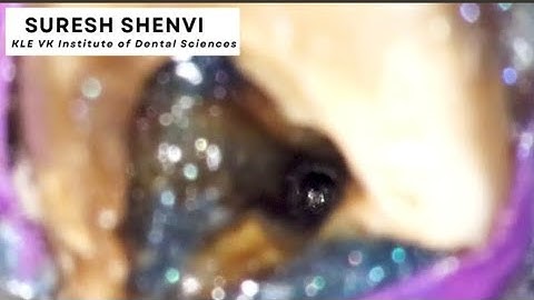 instrument Retrieval under microscope !