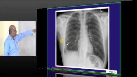 NEETPG Image Based MCQ Discussion in AIPGMEE Mock Test  1375 Lec 03