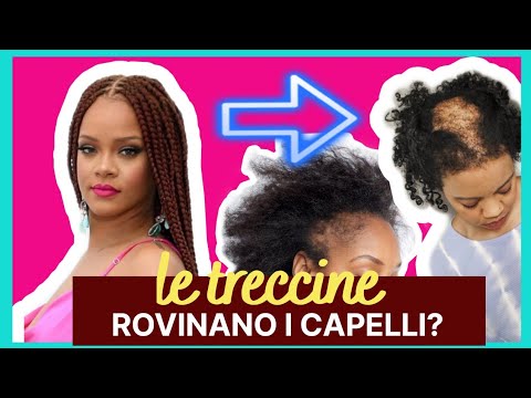 le trecce rovinano i capelli