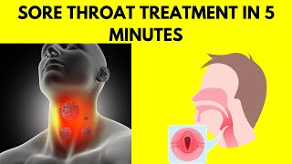 How to treat sore throat at home | Health