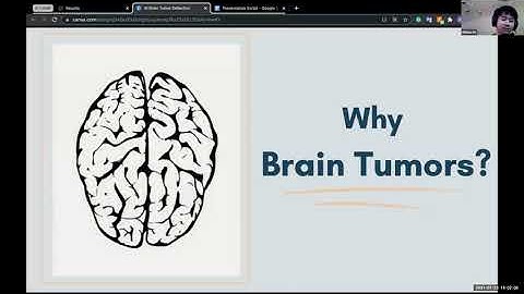 AI Detects Brain Tumors | AI Camp 2021