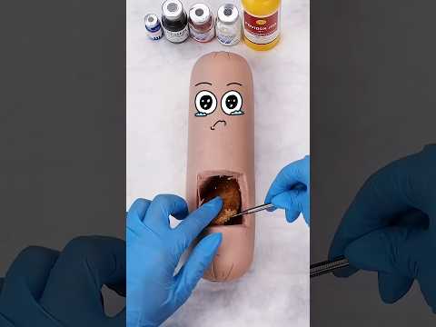 يا دكتور أرجوك أنقذ طفلي 