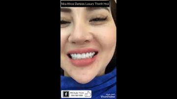 BỌC RĂNG SỨ THẨM MỸ TẠI DENCOS LUXURY THANH HÓA