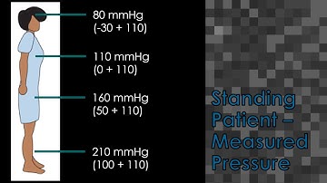 4. Hydrostatic Pressure