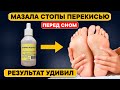 Перекись на стопы. Вот что произошло после 2-го раза!