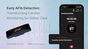 The Frontier X Plus | Continuous Ambulatory ECG Made Effortless