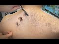 💈ASMR | Remove a lot of vellus hair from the artist's face, back, and head. 🪒 Insane shaving skills