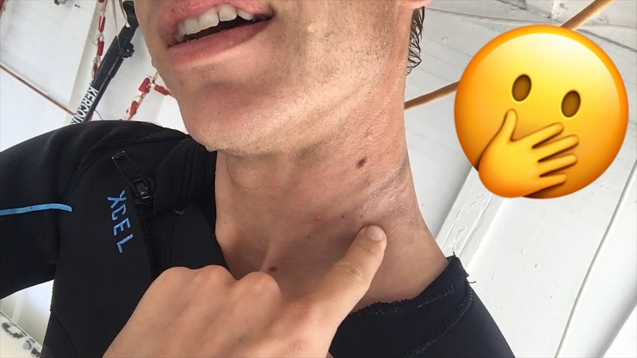 WETSUIT STICKY NECK REPAIR