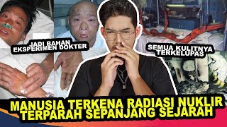 83 HARI KESAKITAN JADI EKSPERIMEN RADIASI NUKLIR | Hisashi Ouchi