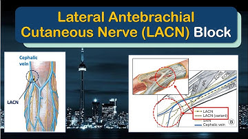 LATERAL ANTEBRACHIAL CUTANEOUS NERVE Block - A "How-To" Guide