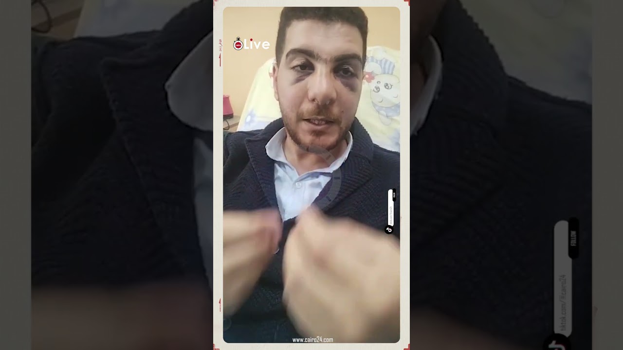 ذنب أمي إيه تتشتم؟.. طبيب عظام مستشفى الباجور يروي لحظة الاعتداء عليه وكسر أنفه أثناء عمله