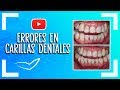 Errores en Carillas Dentales l Tallado, Mal Sellado, Muy Blancos
