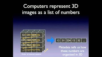 ITK-SNAP User Training, Session 2: Working with 3D Medical Images