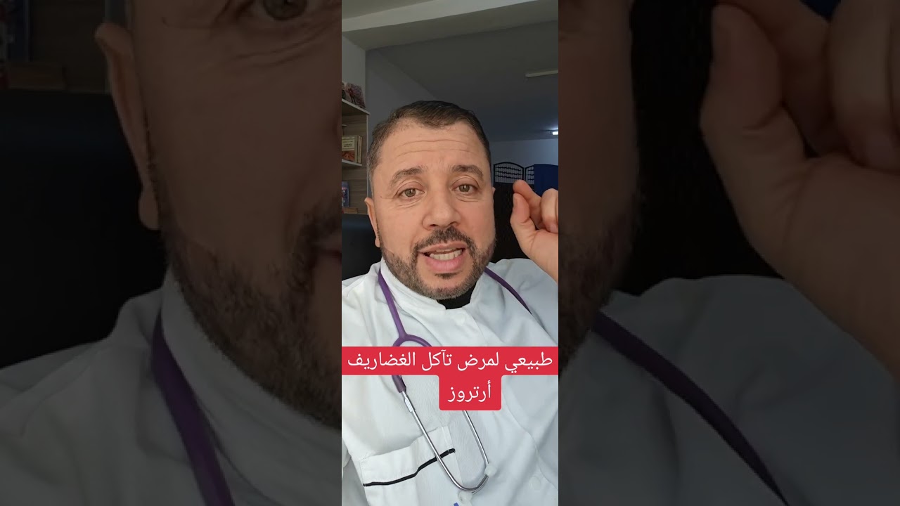 علاج طبيعي لمرض تآكل الغضاريف أرتروز 