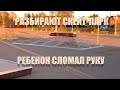 РАЗБИРАЮТ СКЕЙТ-ПАРК, РЕБЕНОК СЛОМАЛ РУКУ