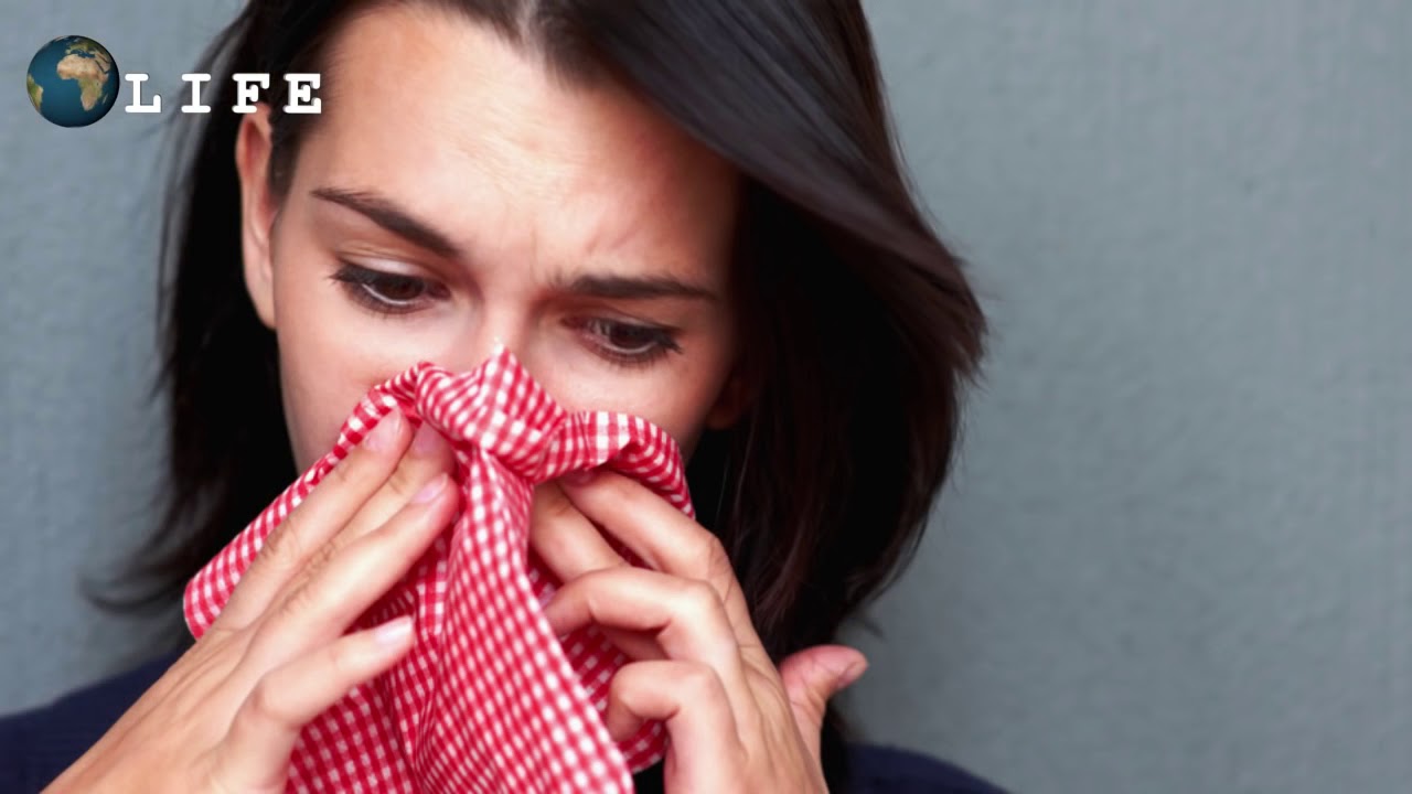 КАК БЫСТРО ОСТАНОВИТЬ КРОВЬ ИЗ НОСА - YouTube