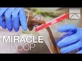 How Fecal Transplants Can Save Lives